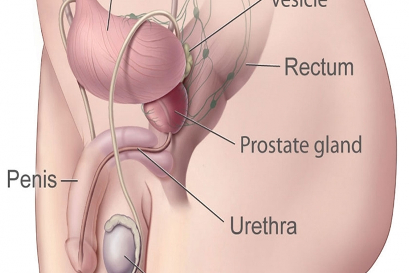 Prostatite cronica: la via crucis medico-paziente